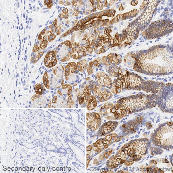 Immunohistochemistry (Formalin/PFA-fixed paraffin-embedded sections) - Avidin/Biotin Blocking Kit (ab64212), expandable thumbnail
