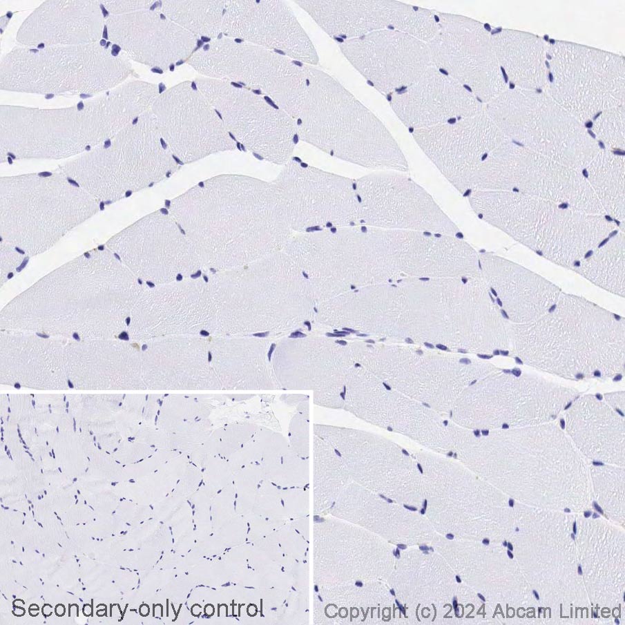 Immunohistochemistry (Formalin/PFA-fixed paraffin-embedded sections) - Avidin/Biotin Blocking Kit (ab64212), expandable thumbnail