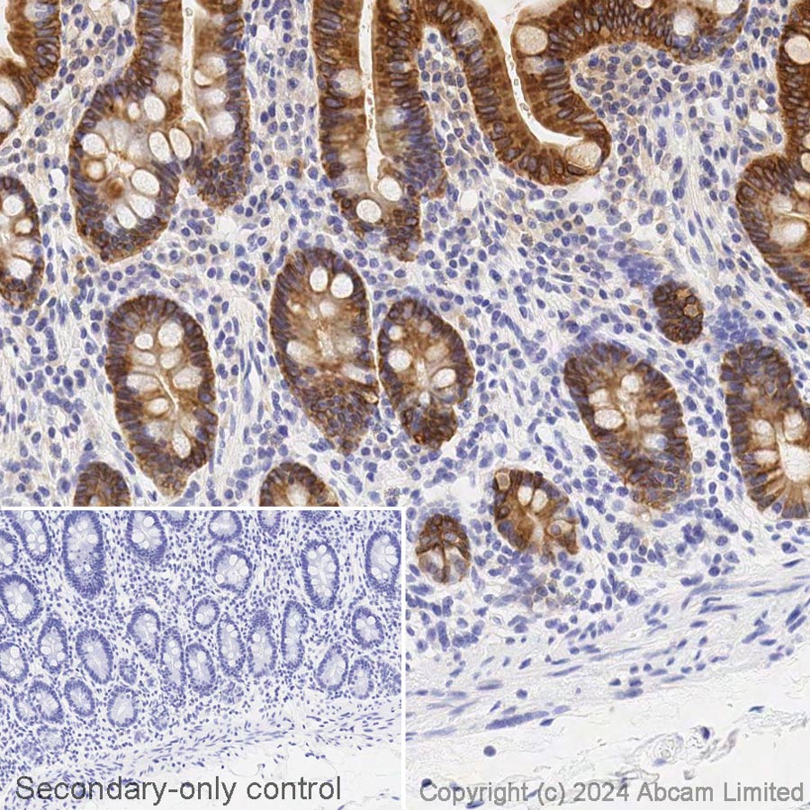 Immunohistochemistry (Formalin/PFA-fixed paraffin-embedded sections) - Avidin/Biotin Blocking Kit (ab64212), expandable thumbnail