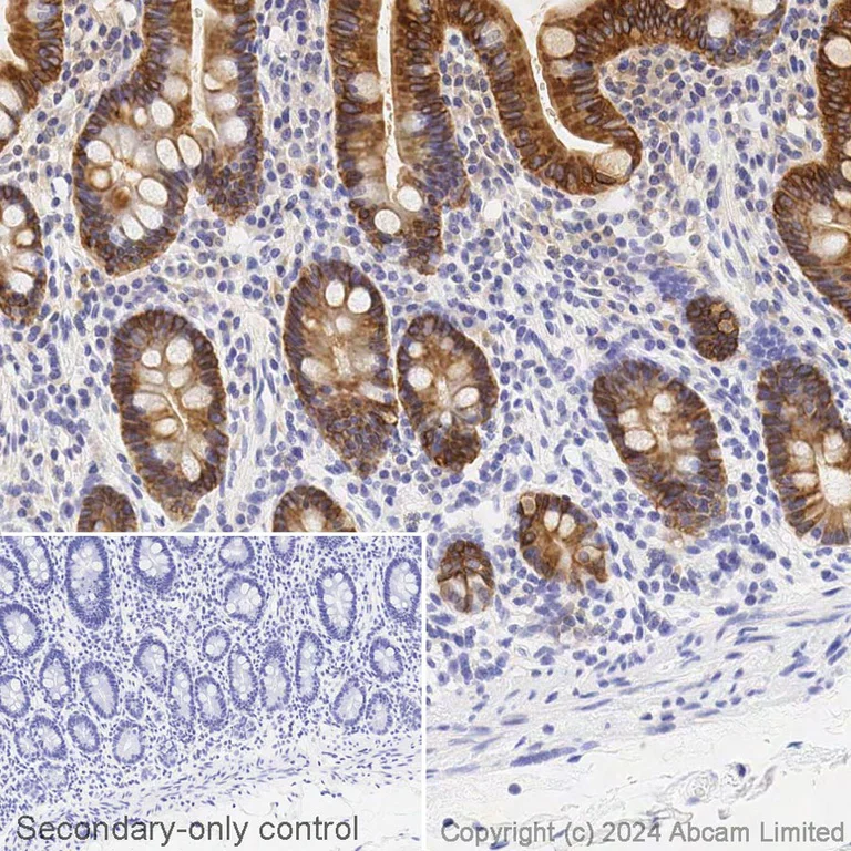 Immunohistochemistry (Formalin/PFA-fixed paraffin-embedded sections) - Avidin/Biotin Blocking Kit (AB64212)