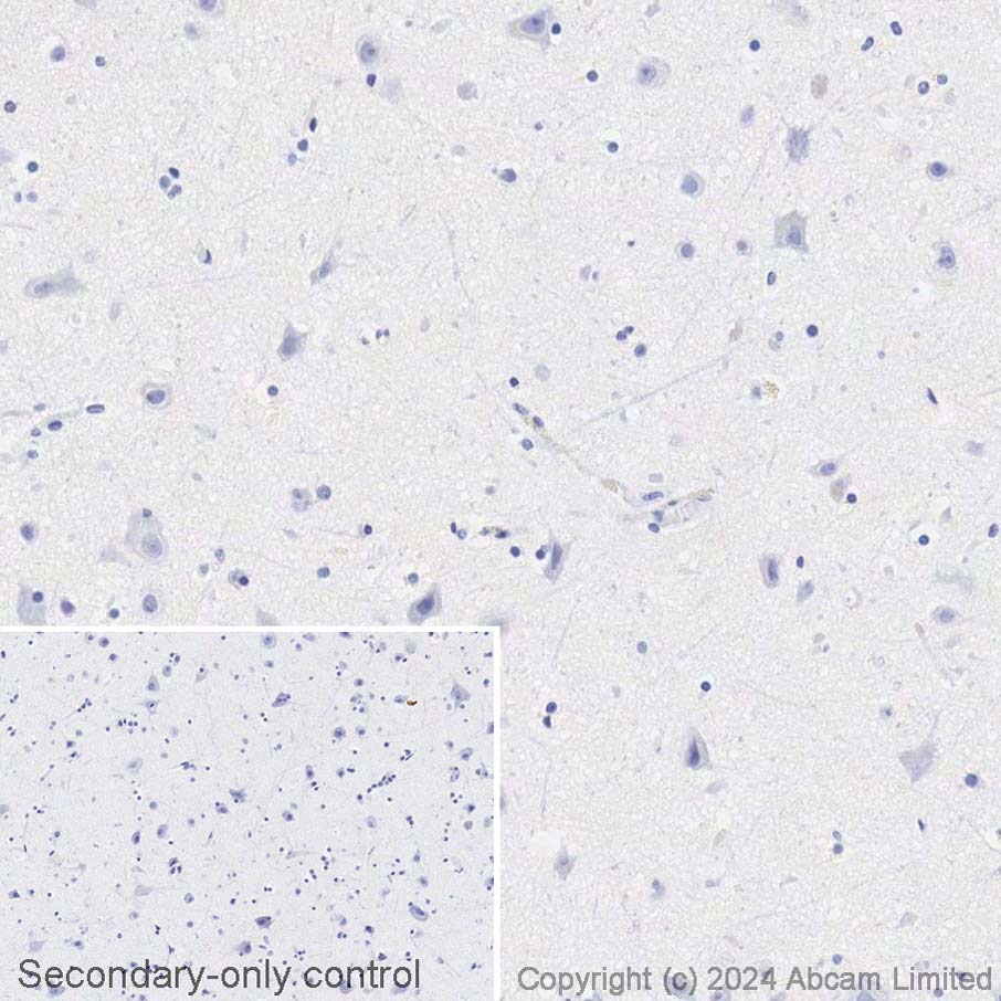 Immunohistochemistry (Formalin/PFA-fixed paraffin-embedded sections) - Avidin/Biotin Blocking Kit (ab64212), expandable thumbnail