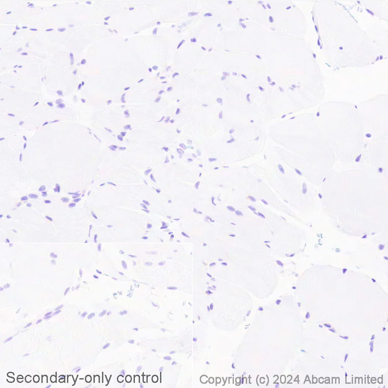 Immunohistochemistry (Formalin/PFA-fixed paraffin-embedded sections) - Avidin/Biotin Blocking Kit (AB64212)