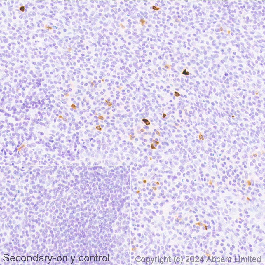 Immunohistochemistry (Formalin/PFA-fixed paraffin-embedded sections) - Avidin/Biotin Blocking Kit (ab64212), expandable thumbnail