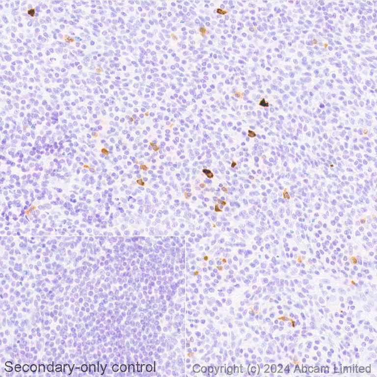 Immunohistochemistry (Formalin/PFA-fixed paraffin-embedded sections) - Avidin/Biotin Blocking Kit (AB64212)