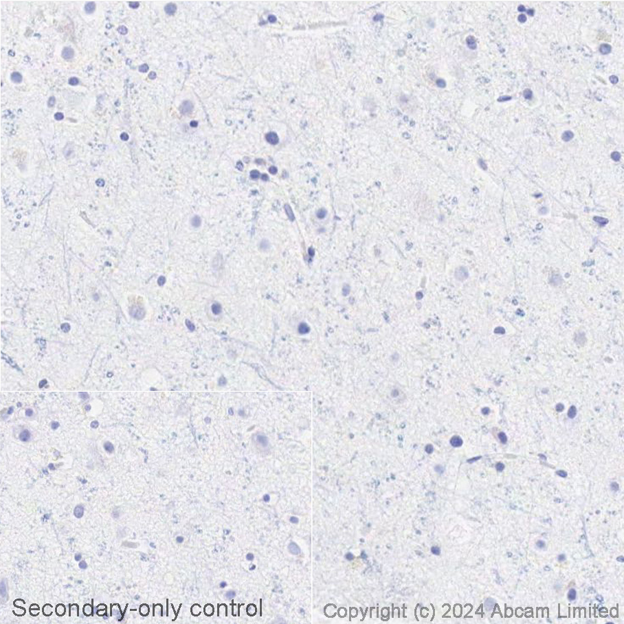 Immunohistochemistry (Formalin/PFA-fixed paraffin-embedded sections) - Avidin/Biotin Blocking Kit (ab64212), expandable thumbnail