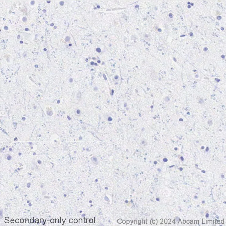Immunohistochemistry (Formalin/PFA-fixed paraffin-embedded sections) - Avidin/Biotin Blocking Kit (AB64212)
