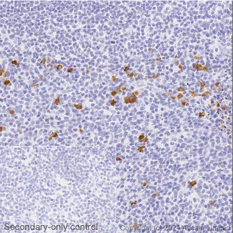 Immunohistochemistry (Formalin/PFA-fixed paraffin-embedded sections) - Avidin/Biotin Blocking Kit (AB64212)