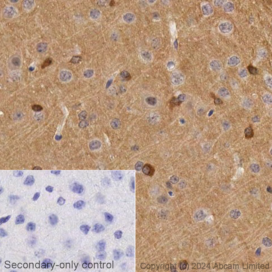 Immunohistochemistry (Formalin/PFA-fixed paraffin-embedded sections) - Avidin/Biotin Blocking Kit (ab64212), expandable thumbnail