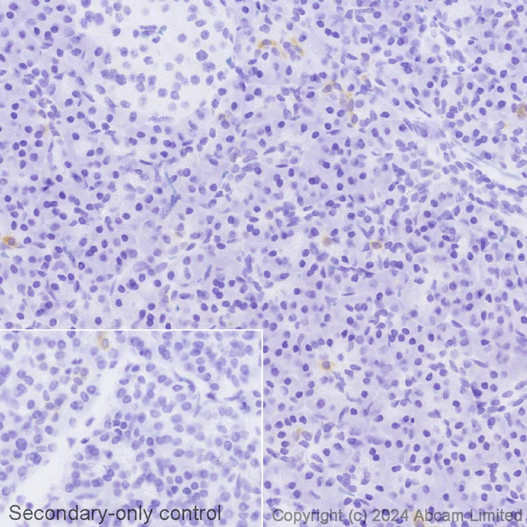 Immunohistochemistry (Formalin/PFA-fixed paraffin-embedded sections) - Avidin/Biotin Blocking Kit (AB64212)