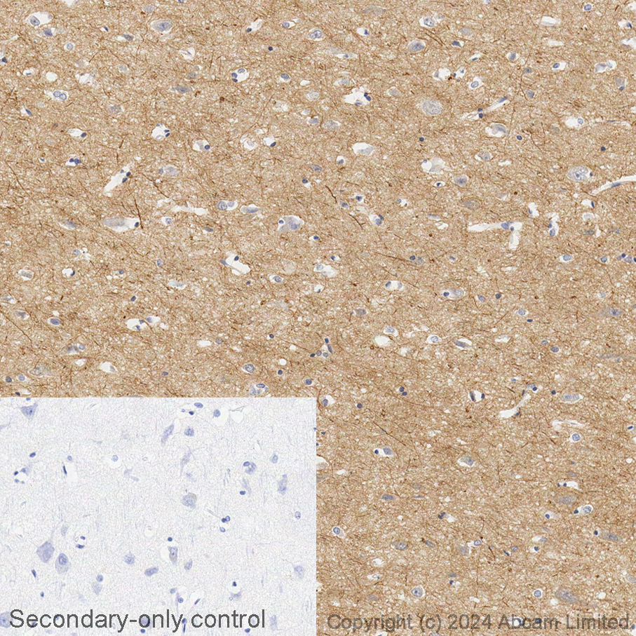Immunohistochemistry (Formalin/PFA-fixed paraffin-embedded sections) - Avidin/Biotin Blocking Kit (ab64212), expandable thumbnail