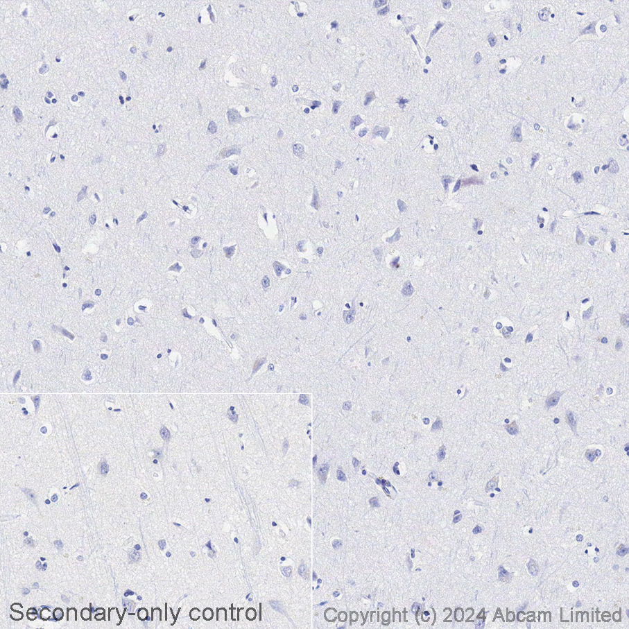 Immunohistochemistry (Formalin/PFA-fixed paraffin-embedded sections) - Avidin/Biotin Blocking Kit (ab64212), expandable thumbnail
