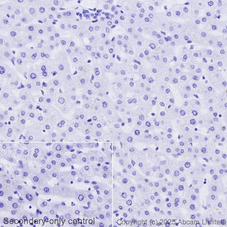 Immunohistochemistry (Formalin/PFA-fixed paraffin-embedded sections) - Avidin/Biotin Blocking Kit (AB64212)