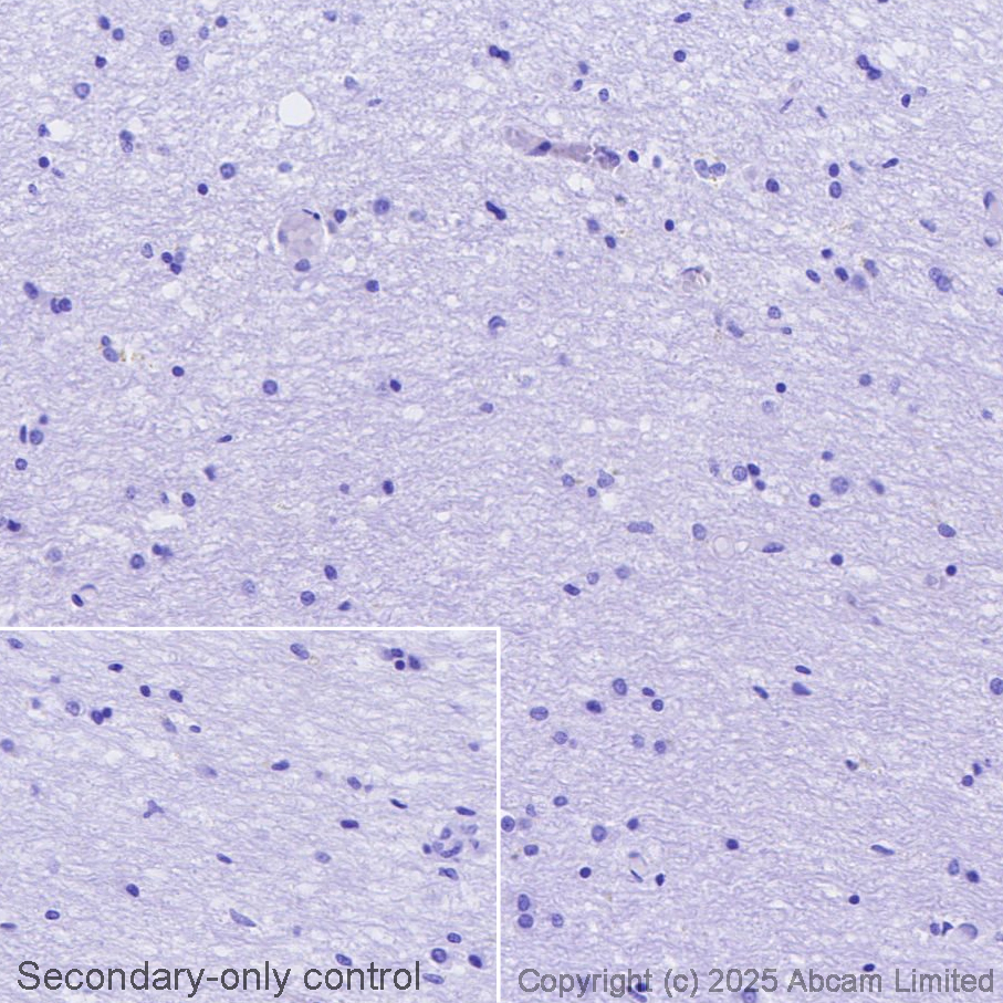 Immunohistochemistry (Formalin/PFA-fixed paraffin-embedded sections) - Avidin/Biotin Blocking Kit (ab64212), expandable thumbnail