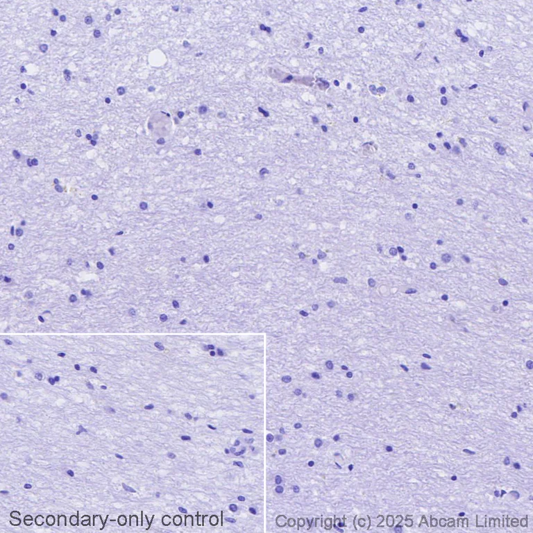 Immunohistochemistry (Formalin/PFA-fixed paraffin-embedded sections) - Avidin/Biotin Blocking Kit (AB64212)