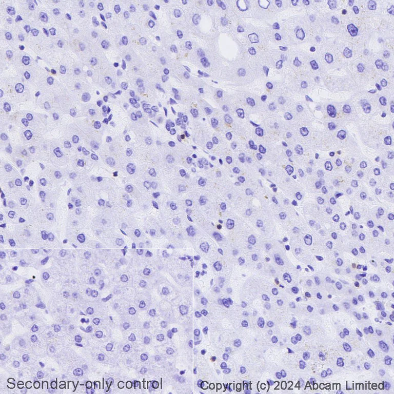 Immunohistochemistry (Formalin/PFA-fixed paraffin-embedded sections) - Avidin/Biotin Blocking Kit (AB64212)