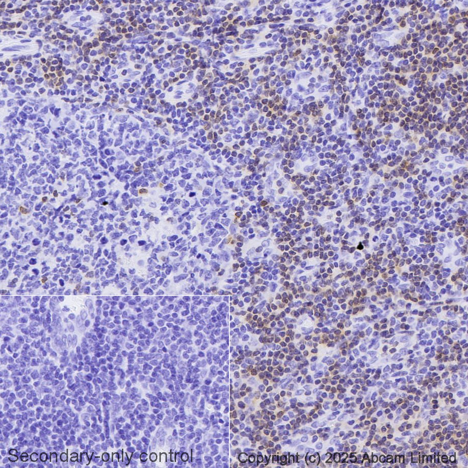 Immunohistochemistry (Formalin/PFA-fixed paraffin-embedded sections) - Avidin/Biotin Blocking Kit (AB64212), expandable thumbnail