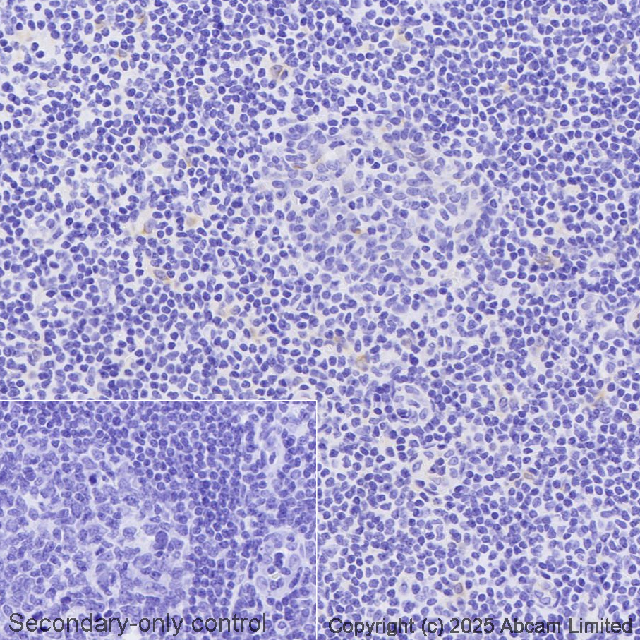 Immunohistochemistry (Formalin/PFA-fixed paraffin-embedded sections) - Avidin/Biotin Blocking Kit (ab64212), expandable thumbnail