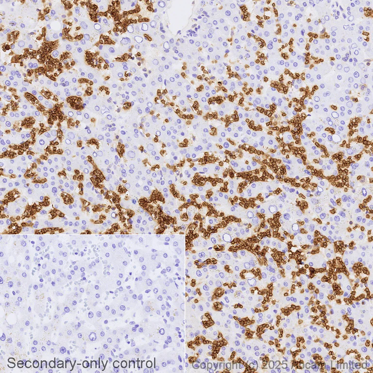 Immunohistochemistry (Formalin/PFA-fixed paraffin-embedded sections) - Avidin/Biotin Blocking Kit (AB64212)