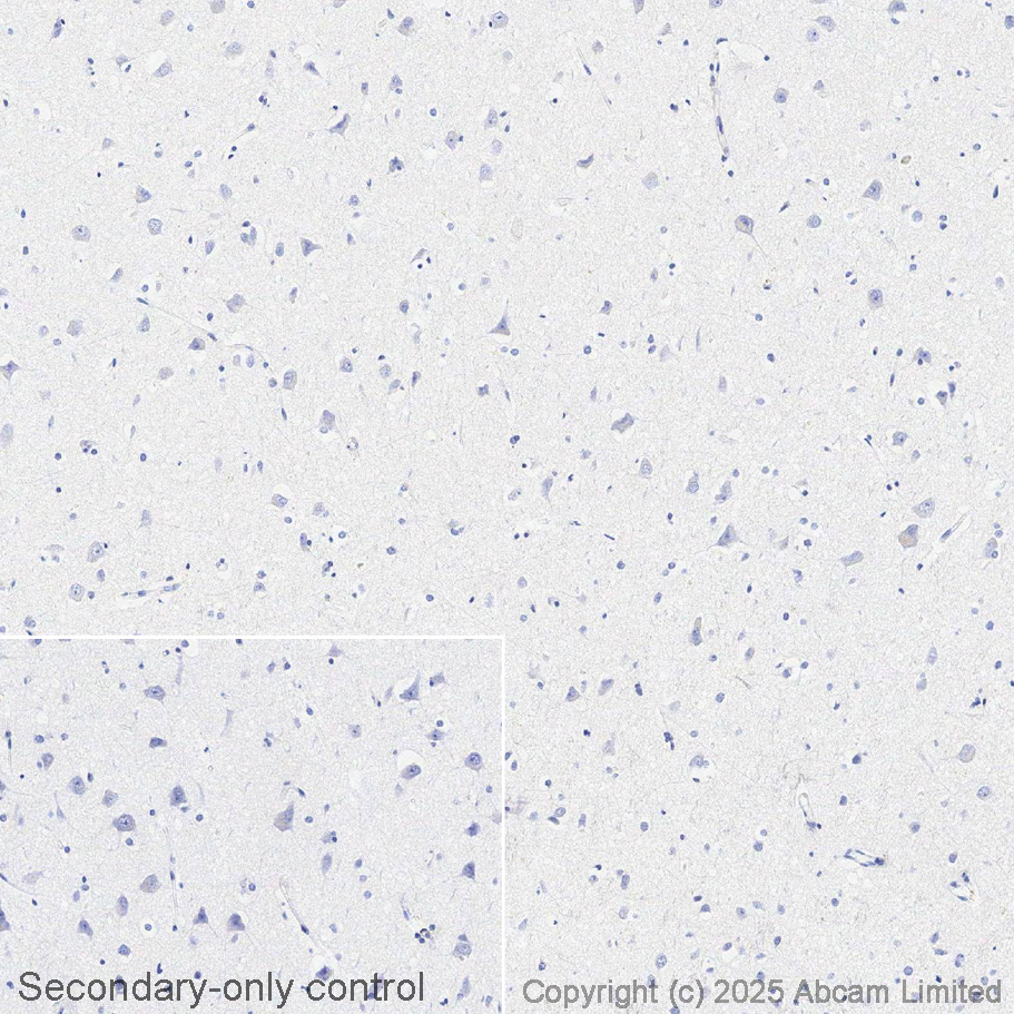 Immunohistochemistry (Formalin/PFA-fixed paraffin-embedded sections) - Avidin/Biotin Blocking Kit (AB64212), expandable thumbnail