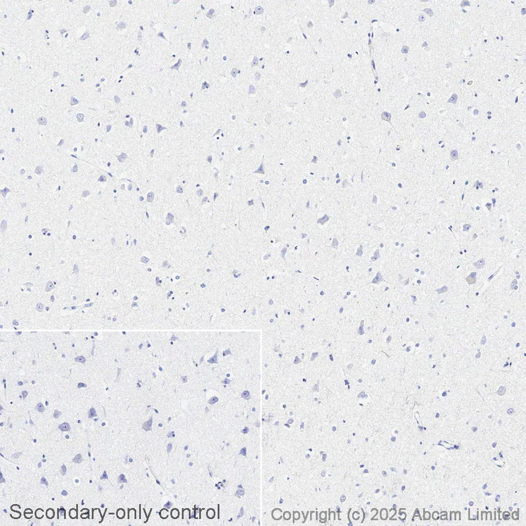 Immunohistochemistry (Formalin/PFA-fixed paraffin-embedded sections) - Avidin/Biotin Blocking Kit (AB64212)