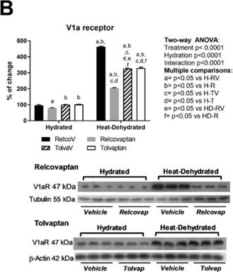 Western blot - Anti-AVPR1A/V1aR antibody (AB187753), expandable thumbnail