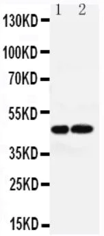 Western blot - Anti-AVPR1A/V1aR antibody (AB187753)