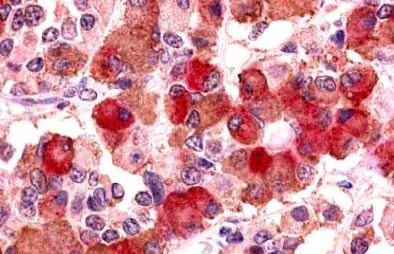 Immunohistochemistry (Formalin/PFA-fixed paraffin-embedded sections) - Anti-AVPR1B antibody - Cytoplasmic domain (AB140500)