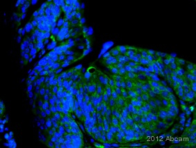Immunohistochemistry (Formalin/PFA-fixed paraffin-embedded sections) - Anti-Axin 1 antibody (AB115205), expandable thumbnail