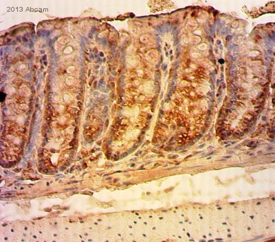 Immunohistochemistry (Formalin/PFA-fixed paraffin-embedded sections) - Anti-Axin 2 antibody (AB107613)