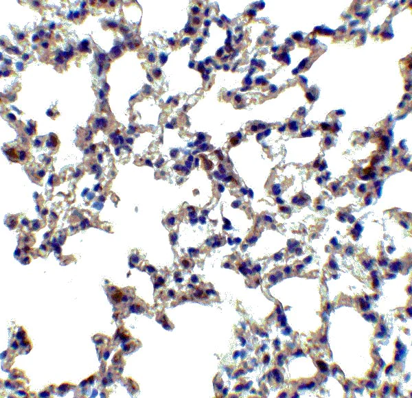 Anti-Axin 2 antibody (ab107613) | Abcam