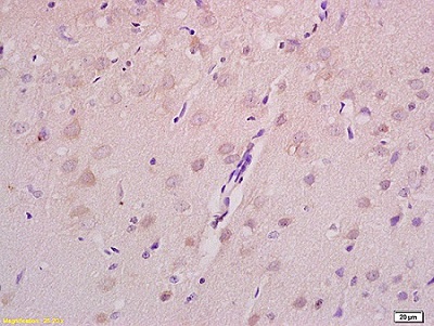 Immunohistochemistry (Formalin/PFA-fixed paraffin-embedded sections) - Anti-Axin 2 antibody (AB218023)