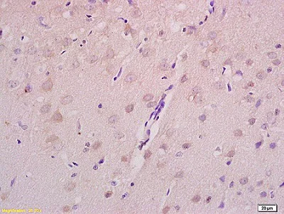 Immunohistochemistry (Formalin/PFA-fixed paraffin-embedded sections) - Anti-Axin 2 antibody (AB218023)