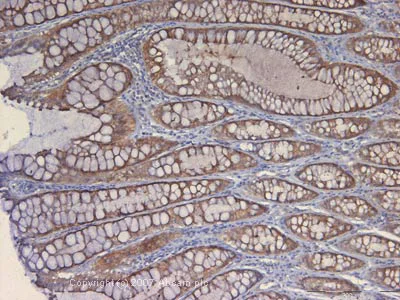 Immunohistochemistry (Formalin/PFA-fixed paraffin-embedded sections) - Anti-Axin 2 antibody (AB32197)