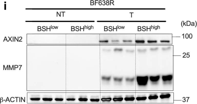 Western blot - Anti-Axin 2 antibody (AB32197)