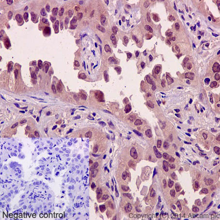 Immunohistochemistry (Formalin/PFA-fixed paraffin-embedded sections) - Anti-Axin 2 antibody [EPR2005(2)] (AB109307), expandable thumbnail