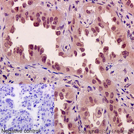Immunohistochemistry (Formalin/PFA-fixed paraffin-embedded sections) - Anti-Axin 2 antibody [EPR2005(2)] (AB109307), expandable thumbnail