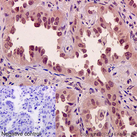 Immunohistochemistry (Formalin/PFA-fixed paraffin-embedded sections) - Anti-Axin 2 antibody [EPR2005(2)] (AB109307)