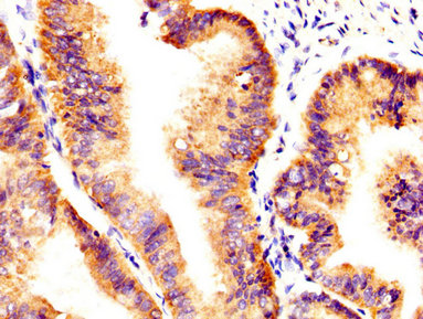 Immunohistochemistry (Formalin/PFA-fixed paraffin-embedded sections) - Anti-Axl antibody (AB235964)