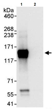 Immunoprecipitation - Anti-Axl antibody (AB245302)