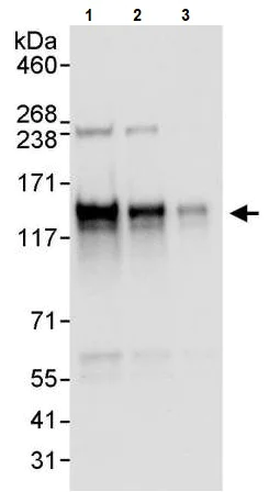 Western blot - Anti-Axl antibody (AB245302)