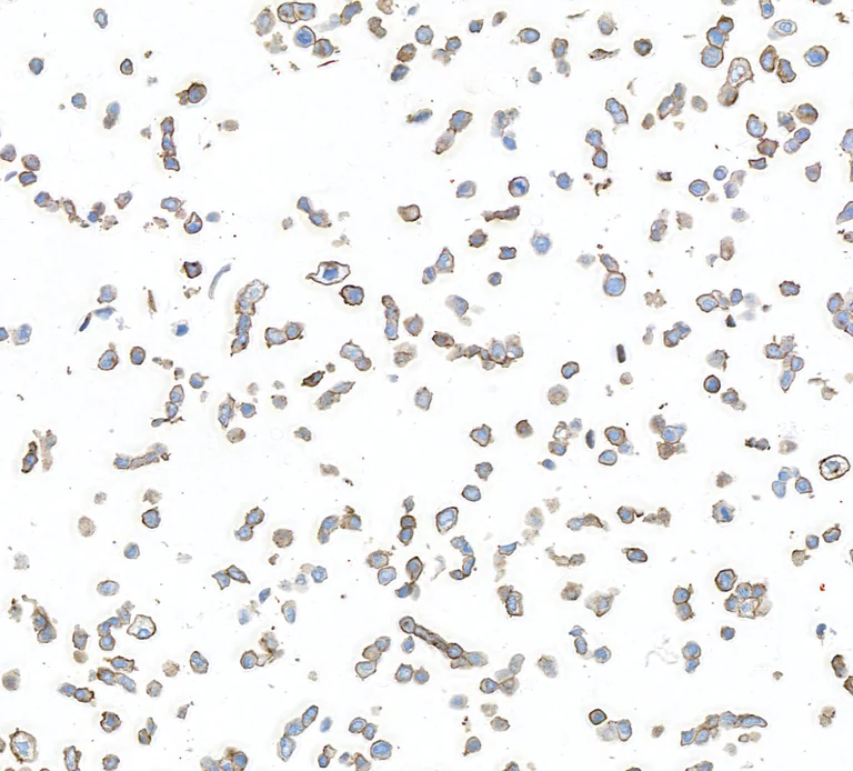 Immunocytochemistry - Anti-AXL antibody [BLR222K] - BSA free (AB314097)