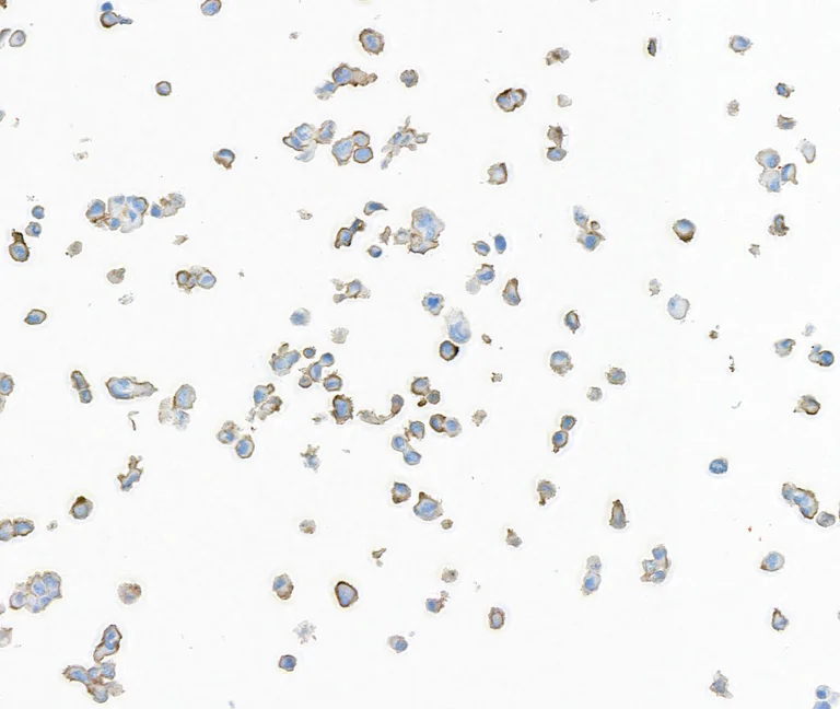 Immunocytochemistry - Anti-AXL antibody [BLR222K] - BSA free (AB314097)