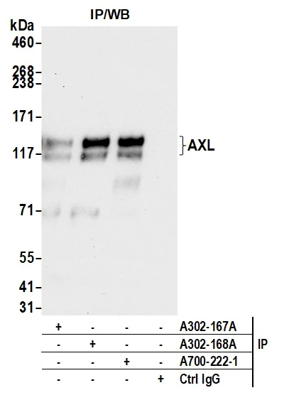 Immunoprecipitation - Anti-AXL antibody [BLR222K] - BSA free (AB314097)