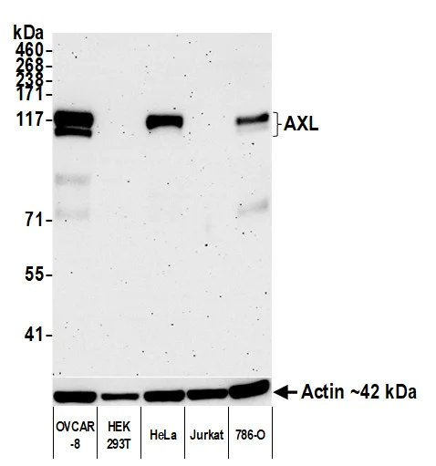Western blot - Anti-AXL antibody [BLR222K] - BSA free (AB314097)