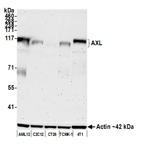 Western blot - Anti-AXL antibody [BLR222K] - BSA free (AB314097)