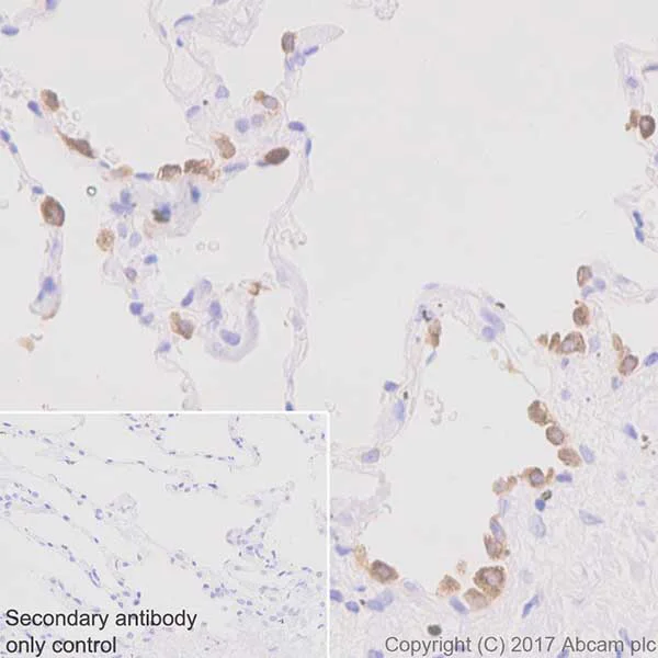 Immunohistochemistry (Formalin/PFA-fixed paraffin-embedded sections) - Anti-Axl antibody [EPR19880] (AB219651)