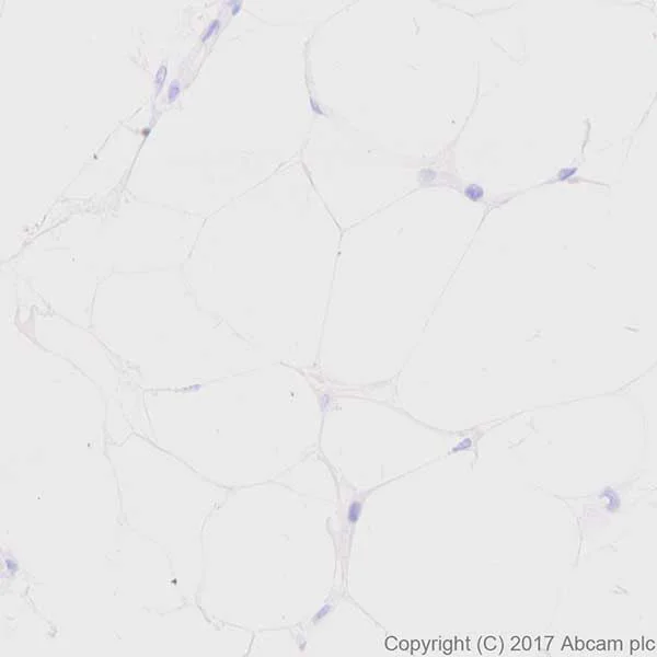 Immunohistochemistry (Formalin/PFA-fixed paraffin-embedded sections) - Anti-Axl antibody [EPR19880] (AB219651)