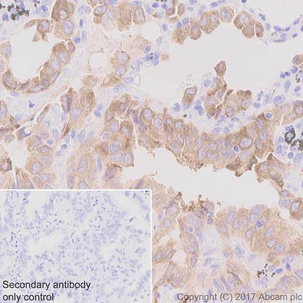 Immunohistochemistry (Formalin/PFA-fixed paraffin-embedded sections) - Anti-Axl antibody [EPR19880] - BSA and Azide free (AB240396)