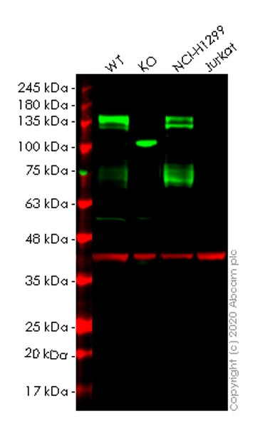 Western blot - Anti-Axl antibody [EPR21107] (AB215205), expandable thumbnail