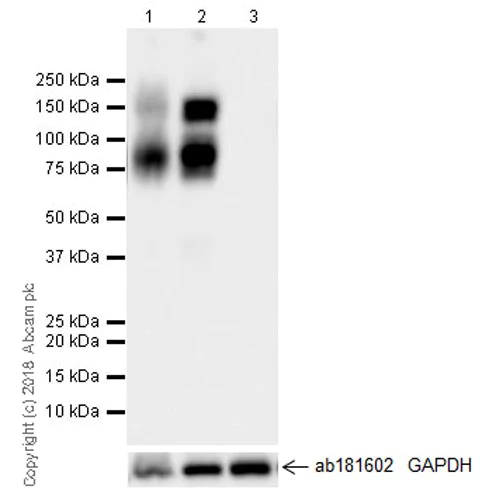 Western blot - Anti-Axl antibody [EPR21107] (AB215205)